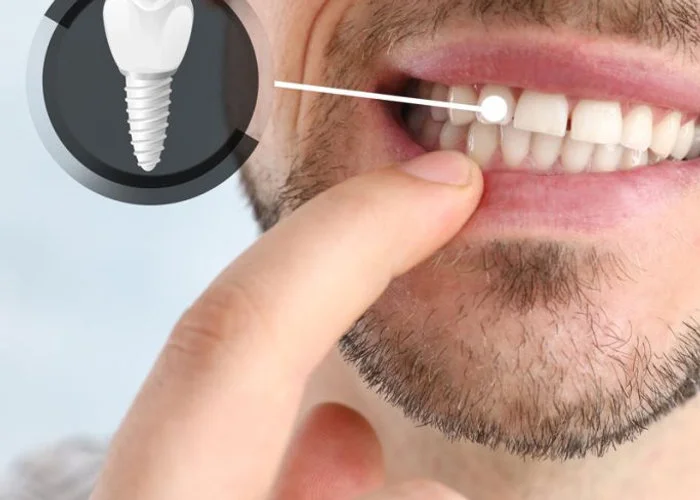 Specialista Nuovi Denti