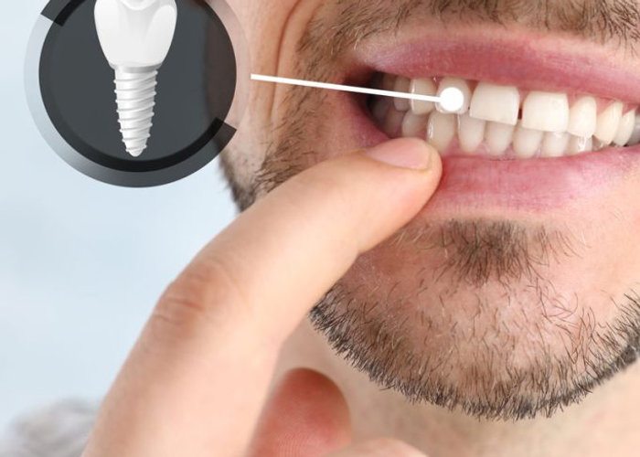Specialista Nuovi Denti