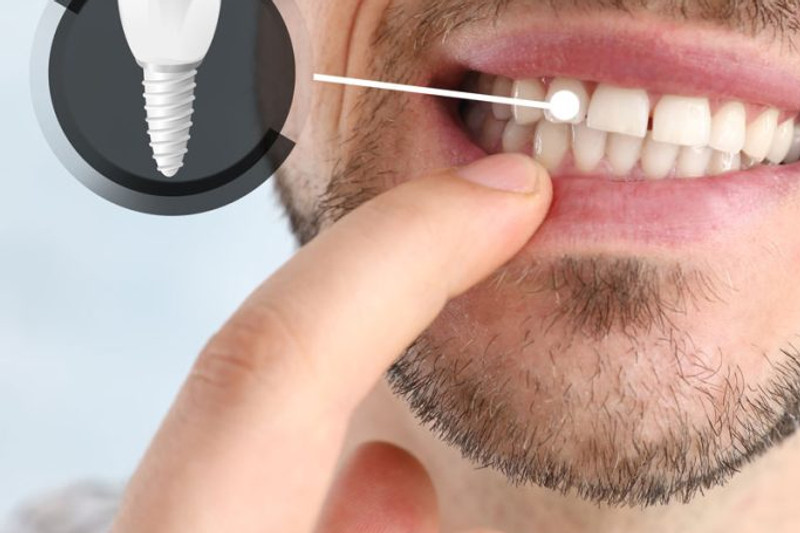 Igiene Professionale