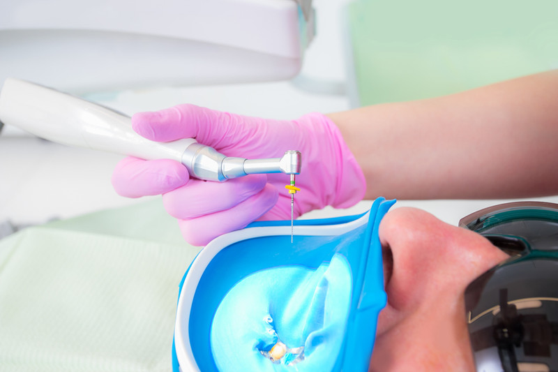 Impianto dentale a Tirana realizzato dalla clinica Nuovi Denti